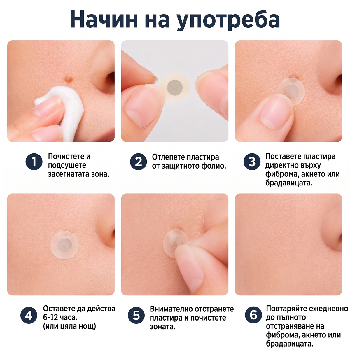 ✅✅ 𝐎𝐟𝐟𝐢𝐜𝐢𝐚𝐥 𝐒𝐭𝐨𝐫𝐞 | MURWON® 🌥️Билков хидроколоиден пластир с микроигли (За фиброми, малки кожни израстъци, брадавици, бенки, старчески петна и пигментация)❤️