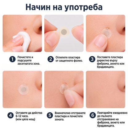 ✅✅ 𝐎𝐟𝐟𝐢𝐜𝐢𝐚𝐥 𝐒𝐭𝐨𝐫𝐞 | MURWON® 🌥️Билков хидроколоиден пластир с микроигли (За фиброми, малки кожни израстъци, брадавици, бенки, старчески петна и пигментация)❤️