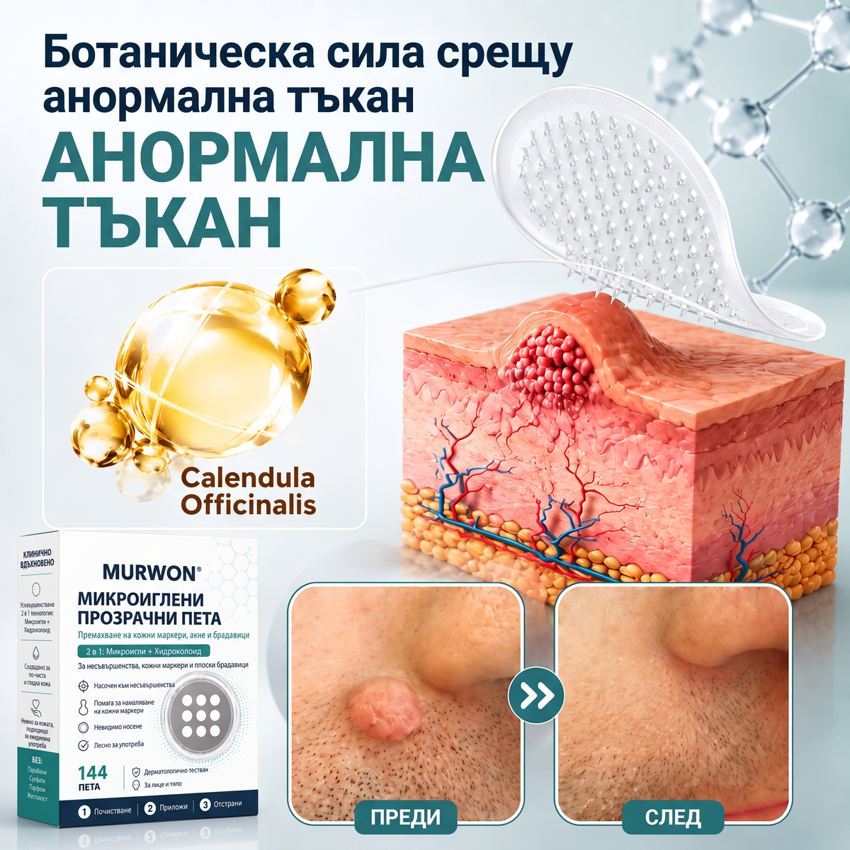 ✅✅ 𝐎𝐟𝐟𝐢𝐜𝐢𝐚𝐥 𝐒𝐭𝐨𝐫𝐞 | MURWON® 🌥️Билков хидроколоиден пластир с микроигли (За фиброми, малки кожни израстъци, брадавици, бенки, старчески петна и пигментация)❤️