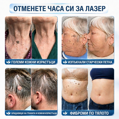 🇧🇬 Качествено българско производство, бърза вътрешна доставка | MURWON® 🌥️ Лепенки с микроигли за намаляване проявите на несъвършенства по кожата 🥦 (При кожни израстъци, брадавици, бенки, пигментни петна и други видими кожни дефекти.) 🖤