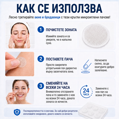 ✅✅ 𝐎𝐟𝐟𝐢𝐜𝐢𝐚𝐥 𝐒𝐭𝐨𝐫𝐞 | MURWON® 🌥️Билков хидроколоиден пластир с микроигли (За фиброми, малки кожни израстъци, брадавици, бенки, старчески петна и пигментация)❤️