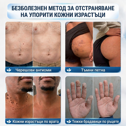 🇧🇬 Качествено българско производство, бърза вътрешна доставка | MURWON® 🌥️ Лепенки с микроигли за намаляване проявите на несъвършенства по кожата 🥦 (При кожни израстъци, брадавици, бенки, пигментни петна и други видими кожни дефекти.) 🖤