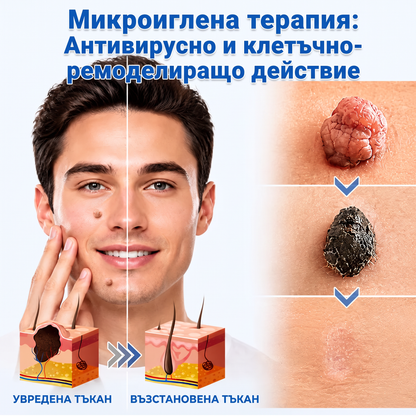 ✅✅ 𝐎𝐟𝐟𝐢𝐜𝐢𝐚𝐥 𝐒𝐭𝐨𝐫𝐞 | MURWON® 🌥️Билков хидроколоиден пластир с микроигли (За фиброми, малки кожни израстъци, брадавици, бенки, старчески петна и пигментация)❤️
