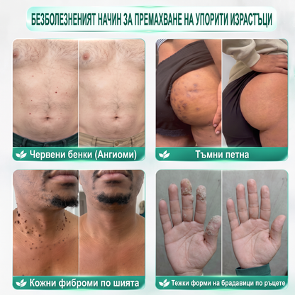 ✅✅ 𝐎𝐟𝐟𝐢𝐜𝐢𝐚𝐥 𝐒𝐭𝐨𝐫𝐞 | MURWON® 🌥️Билков хидроколоиден пластир с микроигли (За фиброми, малки кожни израстъци, брадавици, бенки, старчески петна и пигментация)❤️
